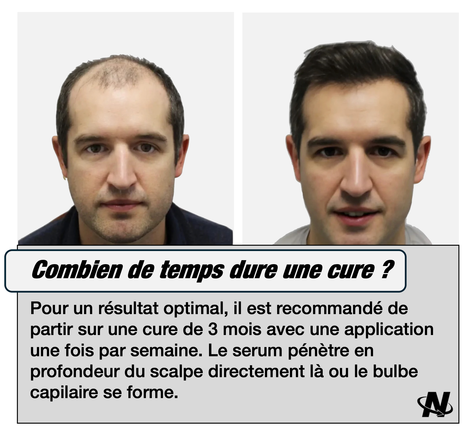 La Cure Nova®