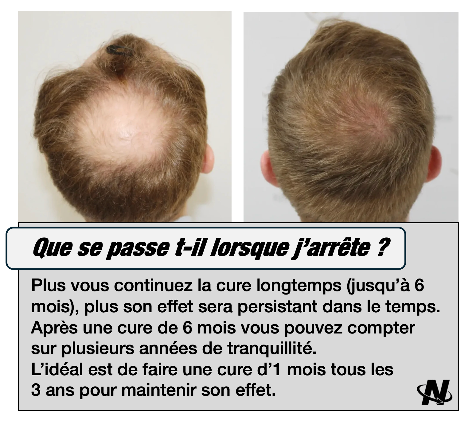 La Cure Nova®