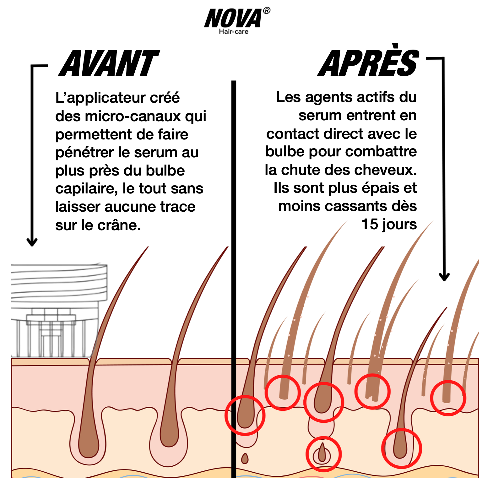 La Cure Nova®